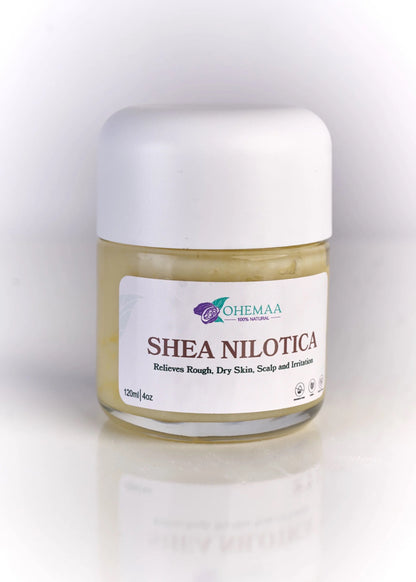 Shea Nilotica